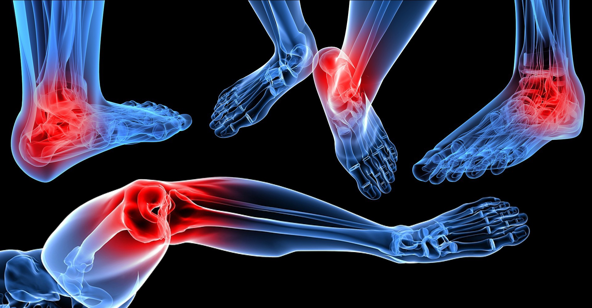 Foot and Ankle Injury Treatment calgary Alberta
