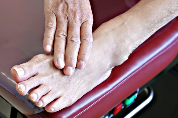 Foot Arthritis Treatment edmonton, Alberta